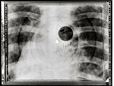 xray_vinyl_2