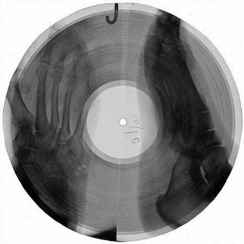 xray_vinyl_3